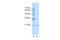 Visual System Homeobox 1 antibody, 29-008, ProSci, Western Blot image 