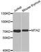 Metastasis Associated 1 Family Member 2 antibody, MBS126701, MyBioSource, Western Blot image 