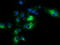 Sequestosome 1 antibody, LS-C172484, Lifespan Biosciences, Immunofluorescence image 