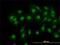 Cofilin 1 antibody, H00001072-M04, Novus Biologicals, Immunofluorescence image 