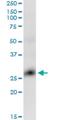 GLI Pathogenesis Related 1 antibody, H00011010-M04, Novus Biologicals, Western Blot image 