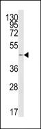 Beta-1,4-Galactosyltransferase 1 antibody, PA5-49655, Invitrogen Antibodies, Western Blot image 