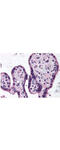Inhibitor Of Nuclear Factor Kappa B Kinase Subunit Beta antibody, A00118, Boster Biological Technology, Immunohistochemistry paraffin image 