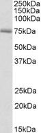 Carnitine O-Octanoyltransferase antibody, EB10729, Everest Biotech, Western Blot image 