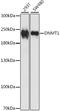 DNA Methyltransferase 1 antibody, A5495, ABclonal Technology, Western Blot image 