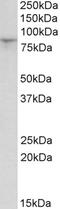 Hyperpolarization Activated Cyclic Nucleotide Gated Potassium Channel 3 antibody, STJ72294, St John