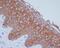 Keratin 14 antibody, M01432-1, Boster Biological Technology, Immunohistochemistry paraffin image 