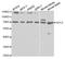 Glypican 3 antibody, TA332471, Origene, Western Blot image 