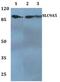 Solute Carrier Family 9 Member A5 antibody, A12116, Boster Biological Technology, Western Blot image 