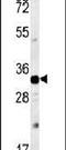 Aquaporin 11 antibody, PA5-25704, Invitrogen Antibodies, Western Blot image 