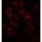 ADP Ribosylation Factor 6 antibody, LS-C201193, Lifespan Biosciences, Immunofluorescence image 