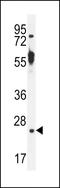 Tetratricopeptide Repeat Domain 9B antibody, LS-C160307, Lifespan Biosciences, Western Blot image 