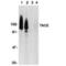 ADAM Metallopeptidase Domain 17 antibody, AHP589, Bio-Rad (formerly AbD Serotec) , Western Blot image 