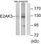 Eukaryotic Translation Initiation Factor 2 Alpha Kinase 3 antibody, PA5-38811, Invitrogen Antibodies, Western Blot image 