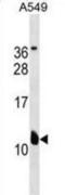 Potassium Voltage-Gated Channel Subfamily E Regulatory Subunit 2 antibody, abx030894, Abbexa, Western Blot image 