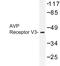 Arginine Vasopressin Receptor 1B antibody, LS-C177308, Lifespan Biosciences, Western Blot image 