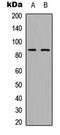 ADAM Metallopeptidase Domain 28 antibody, LS-C354509, Lifespan Biosciences, Western Blot image 