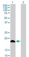 DCMP Deaminase antibody, H00001635-D01P, Novus Biologicals, Western Blot image 