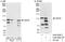 Ubiquitin Specific Peptidase 35 antibody, A302-290A, Bethyl Labs, Immunoprecipitation image 