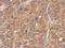 Fetuin B antibody, GTX112260, GeneTex, Immunohistochemistry paraffin image 