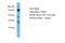 Tonsoku Like, DNA Repair Protein antibody, A07811, Boster Biological Technology, Western Blot image 