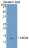 Cystatin A antibody, LS-C298829, Lifespan Biosciences, Western Blot image 