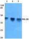 Tachykinin Receptor 2 antibody, A08100, Boster Biological Technology, Western Blot image 