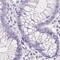 Insulin Like Growth Factor Binding Protein 1 antibody, NBP2-33599, Novus Biologicals, Immunohistochemistry paraffin image 