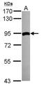 Transglutaminase 2 antibody, NBP2-20698, Novus Biologicals, Western Blot image 
