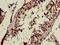 Carbohydrate Sulfotransferase 9 antibody, CSB-PA745332LA01HU, Cusabio, Immunohistochemistry frozen image 