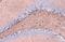 Beta-Secretase 1 antibody, GTX134480, GeneTex, Immunohistochemistry paraffin image 