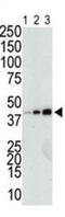 Glutathione-S-Transferase Tag antibody, abx034634, Abbexa, Western Blot image 