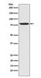 TANK Binding Kinase 1 antibody, M00261, Boster Biological Technology, Western Blot image 