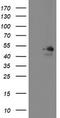 Meis Homeobox 3 antibody, CF800268, Origene, Western Blot image 