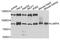 La Ribonucleoprotein Domain Family Member 4 antibody, A5108, ABclonal Technology, Western Blot image 