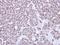 NSE1 Homolog, SMC5-SMC6 Complex Component antibody, LS-C185863, Lifespan Biosciences, Immunohistochemistry paraffin image 