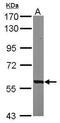 Phosphoglycerate Dehydrogenase antibody, GTX101948, GeneTex, Western Blot image 