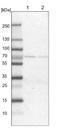 Signal Recognition Particle 68 antibody, NBP1-89532, Novus Biologicals, Western Blot image 