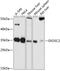 Exosome Component 2 antibody, GTX64892, GeneTex, Western Blot image 