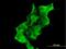 Dystrobrevin Alpha antibody, H00001837-B01P, Novus Biologicals, Immunofluorescence image 