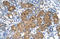 Betaine--Homocysteine S-Methyltransferase antibody, orb330184, Biorbyt, Immunohistochemistry paraffin image 