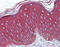 Keratin 17 antibody, 51-971, ProSci, Immunohistochemistry paraffin image 