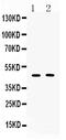 Serpin Family A Member 5 antibody, A01916-1, Boster Biological Technology, Western Blot image 