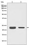 RAB7A, Member RAS Oncogene Family antibody, M02409, Boster Biological Technology, Western Blot image 