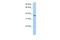 Transmembrane And Coiled-Coil Domain Family 1 antibody, A12960, Boster Biological Technology, Western Blot image 