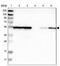Heterogeneous Nuclear Ribonucleoprotein H2 antibody, PA5-53513, Invitrogen Antibodies, Western Blot image 