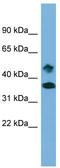 SET Domain Containing 6, Protein Lysine Methyltransferase antibody, TA339159, Origene, Western Blot image 