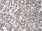Alpha Fetoprotein antibody, CSB-PA787484, Cusabio, Immunohistochemistry paraffin image 