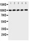 Cbl Proto-Oncogene antibody, PA1800, Boster Biological Technology, Western Blot image 