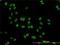 DEAD-Box Helicase 41 antibody, H00051428-M01, Novus Biologicals, Immunocytochemistry image 
